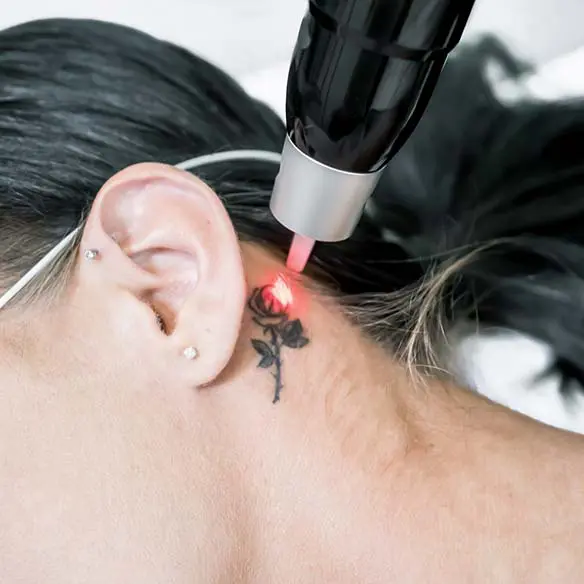 A person is getting their ear marked with laser.